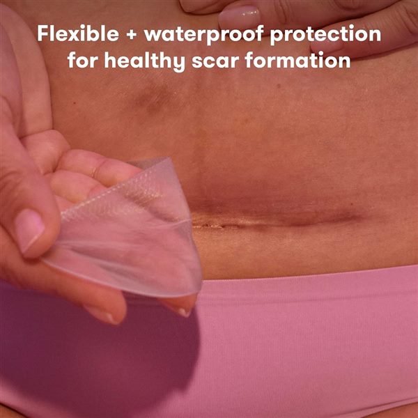 Frida Mom C-Section Silicone Strips